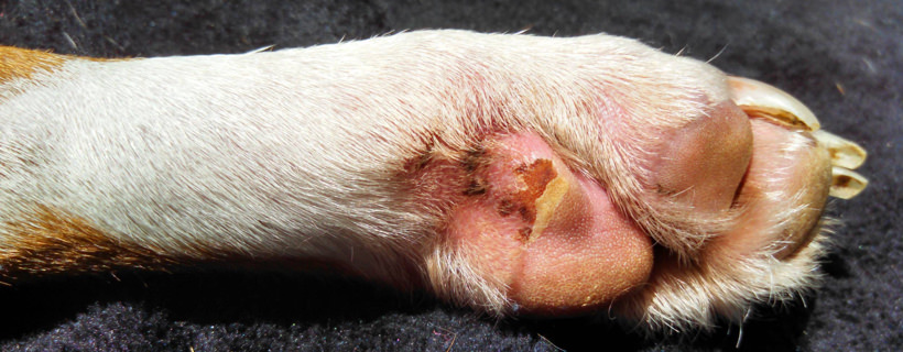 Le infezioni fungine (micosi) - I sintomi e le cause più comuni