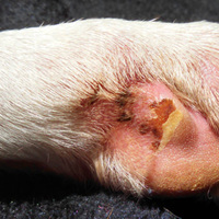 Le infezioni fungine (micosi) - I sintomi e le cause più comuni